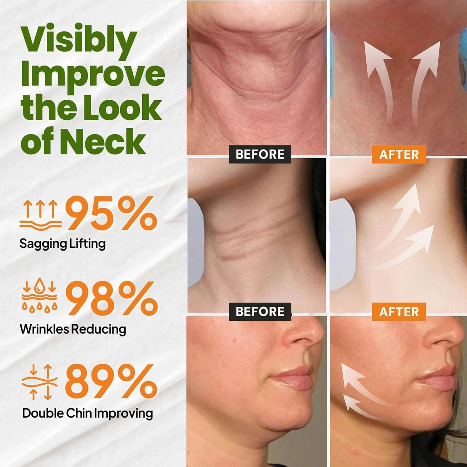 Advanced Skin Tightening Rejuvenating cream, Skin Firming Rejuvenating Serum, Skin Firming Cream, Restore Skin Elasticity, for All Skin Types (4 Bottle)
