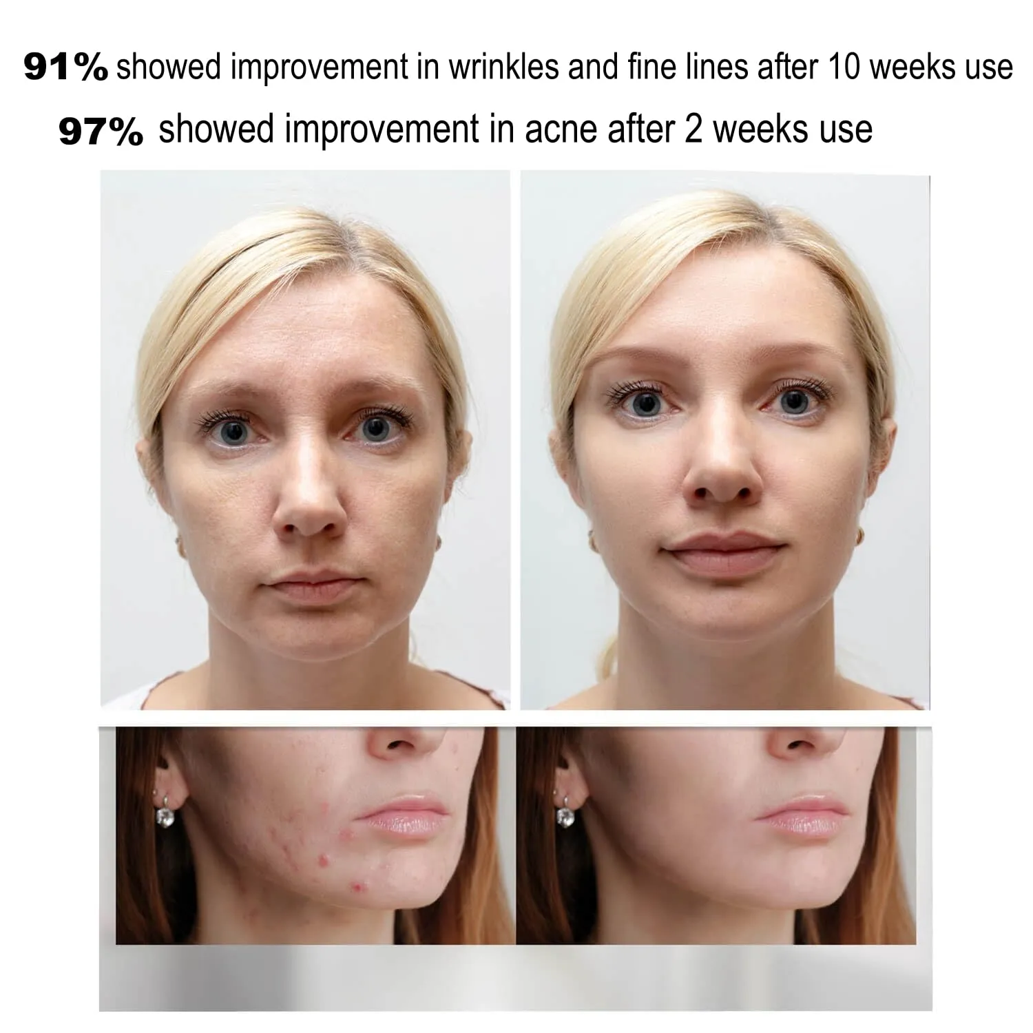 Beauty LED mask - Infrared light therapy led facial light Photons Facial Skin Care Wrinkle reduce anti-acne facial light