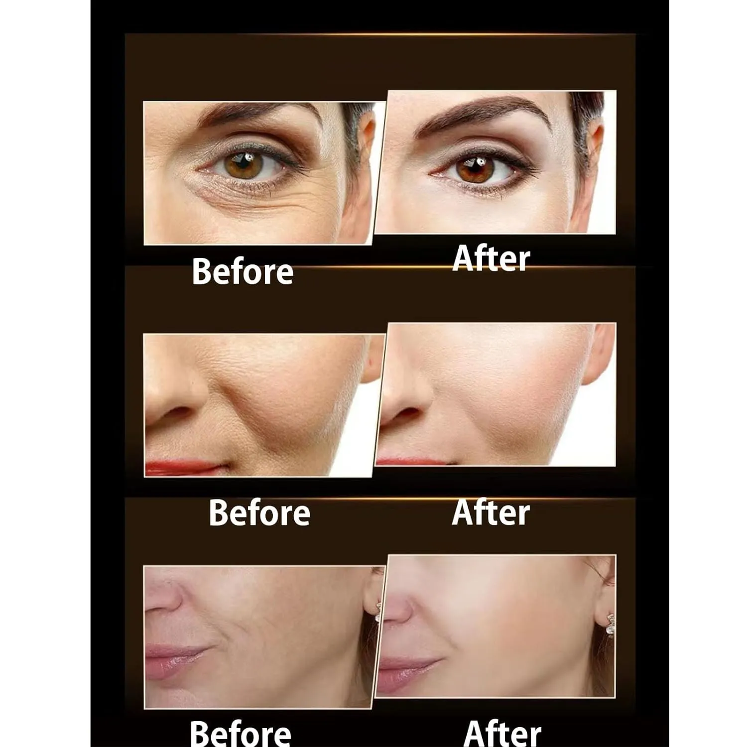 Black Bandage Hyaluronic Acid Active Peptide Anti-Wrinkle Cream,Retinol-Collagen Hyaluronic Acid Face Cream,Black Bandage Face Cream,Black Bandage Face Essence (3PC)