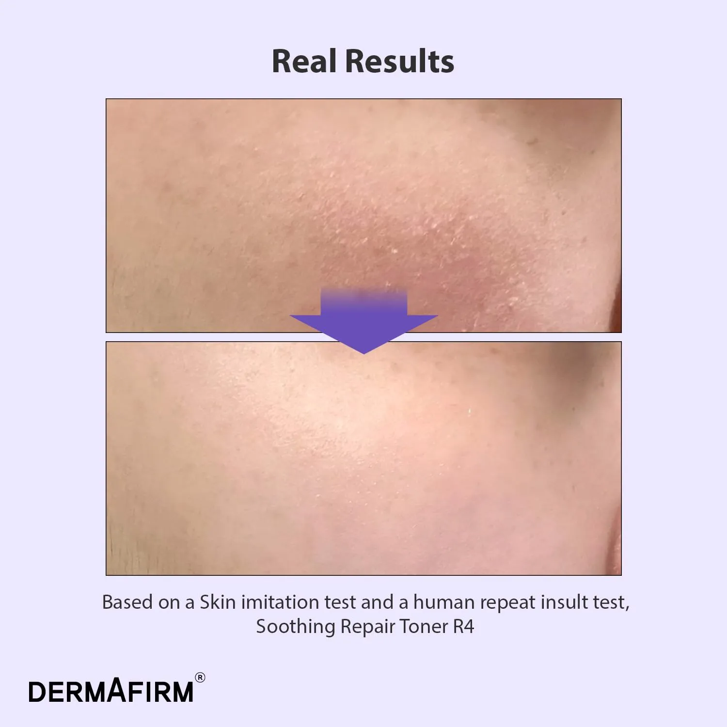 DERMAFIRM Soothing Repair Face Toner R4 | Hydrating Moisturizing & Soothing Toner for Skin Troubles w/Eucalyptus, Peptide & Collagen | Gentle for All Skin Types No Animal Trials No Paraben 6.76 fl oz