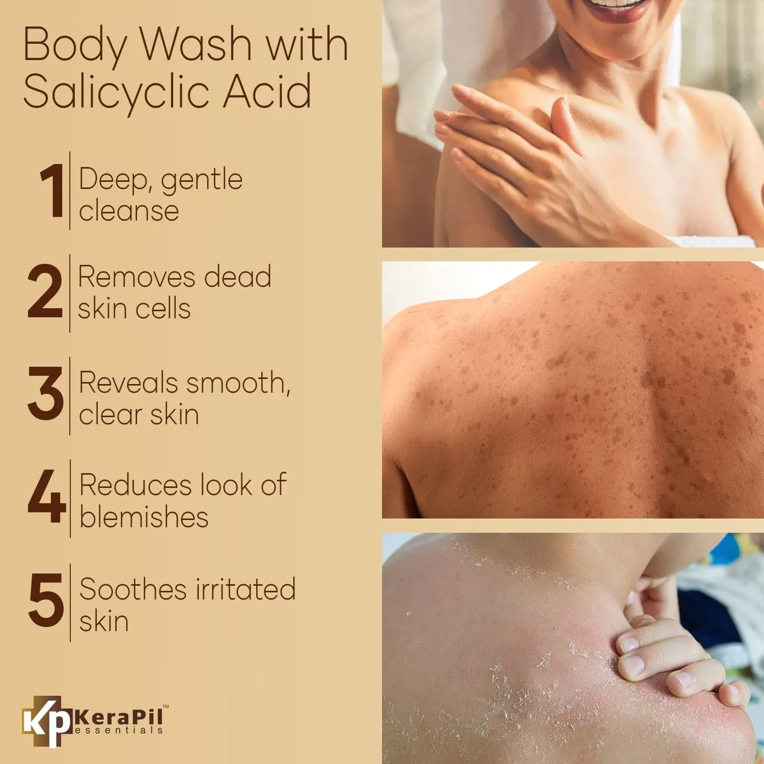 Exfoliating Body Wash with Salicylic Acid - No Dry Out, Gentle Exfoliates Rough and Bumpy Skin, Body Acne Wash, BHA & AHA - Coconut and Vanilla Salicylic Acid Body Wash - (16 fl oz x 2)