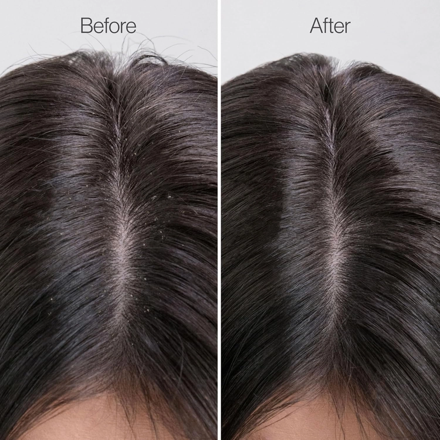Freewill Clarifying Detox Conditioner - Scalp Cleansing Conditioner for Oily Hair, Build Up Remover, Balances Hair Hydration without Stripping, 8.5 oz