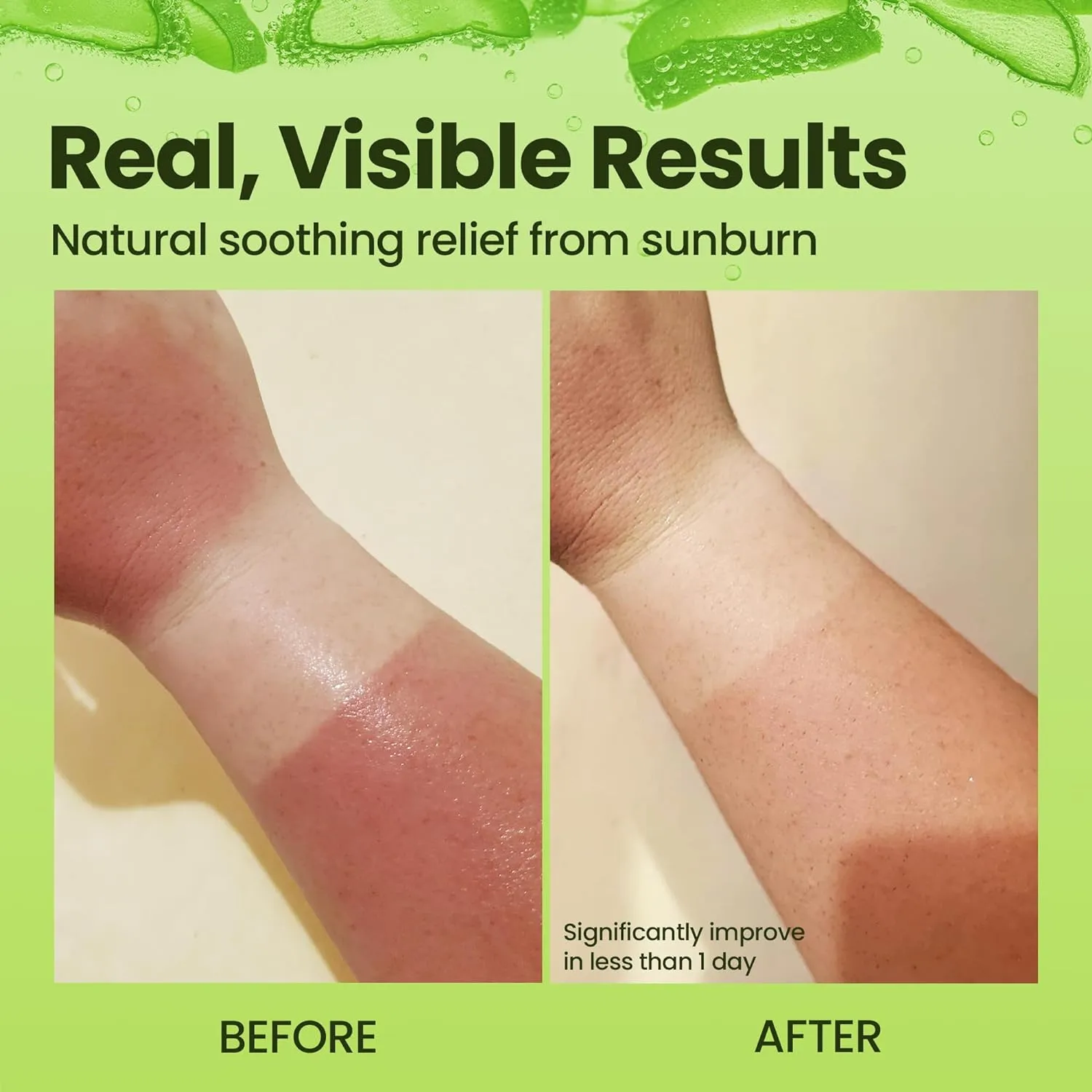 Honeyskin Organic Aloe Vera Gel for Face with Orchid & Apple Stem Cells - Soothing & Hydrating Aloe Gel for Sunburn Relief & After Sun Care - 100% Aloe Vera Gel for Hair, Face & Body (12 Fl Oz)