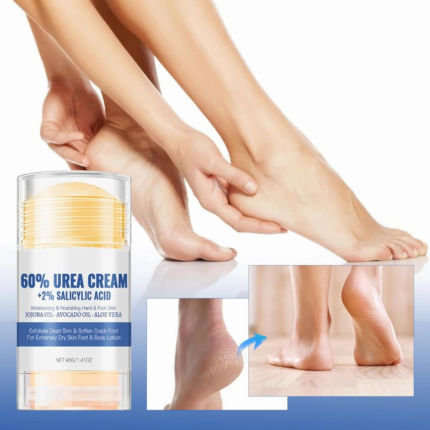 Hydrating and Anti-Cracking Foot Cream, Moisturising and Relieves Cracking and Dryness Foot Cream, Hand and Foot Repair Cream for Women & Men Callused, Feet, Knee, Elbow, Hand (2pcs)