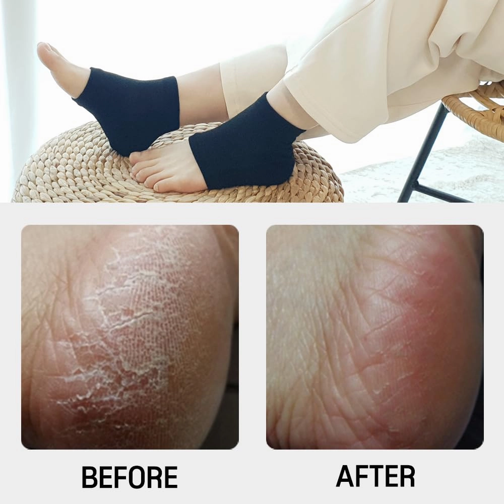 Moisturizing Gel Heel Socks to Repair Dry Cracked Heel - Soften, Soothe, and Revitalize Your Feet, for Men and Women (Mint, 2 Pairs)