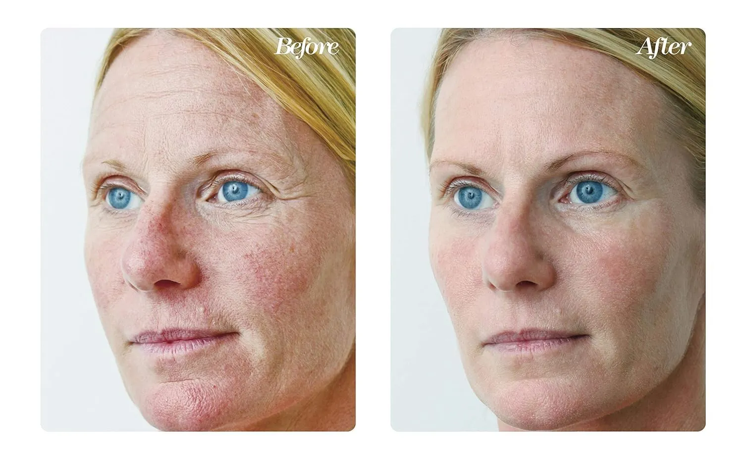 Osmotics Blue Copper 5 Firming Elasticity Repair – Cream for Firmness and Acne. Visible Results, Made in the USA