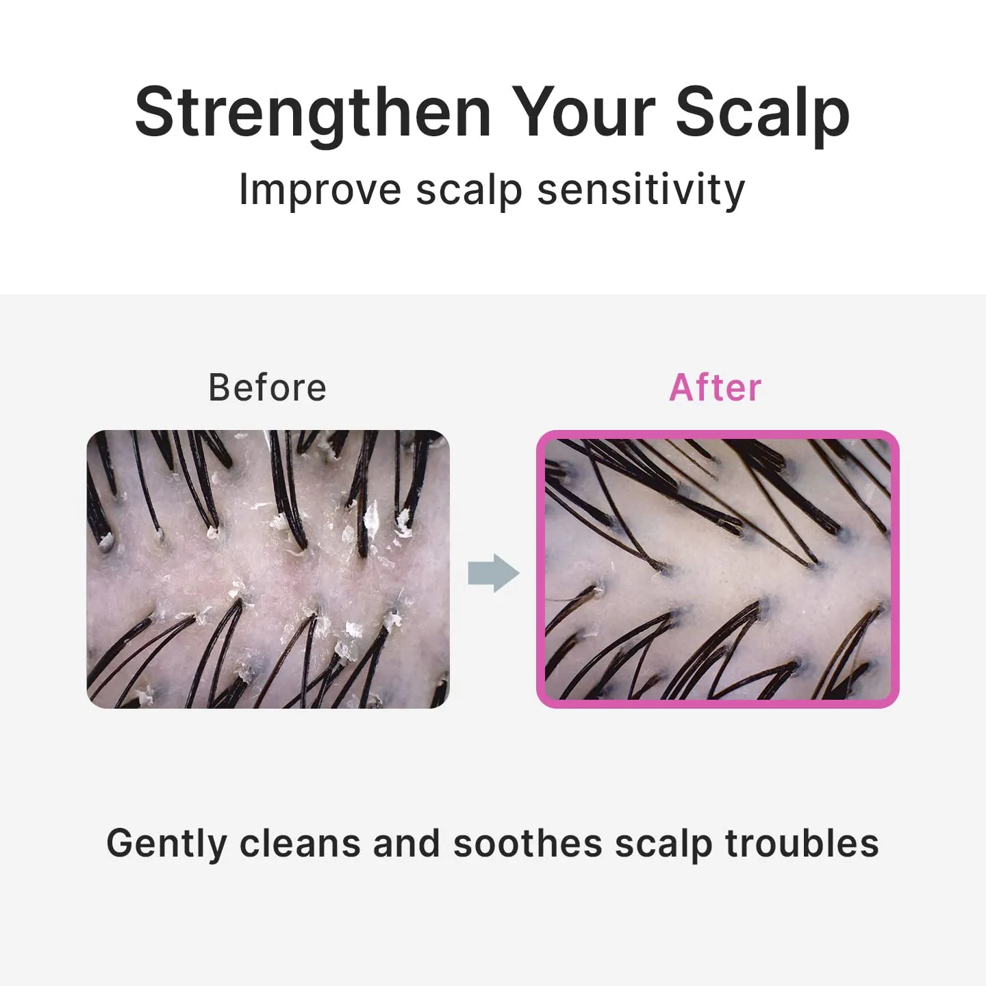 Refreshing Scalp Shampoo | Biotin & Panthenol for Dry, Itchy Scalp | Paraben-Free, Sulfate-Free I Wild Flower I 16.9 fl. oz