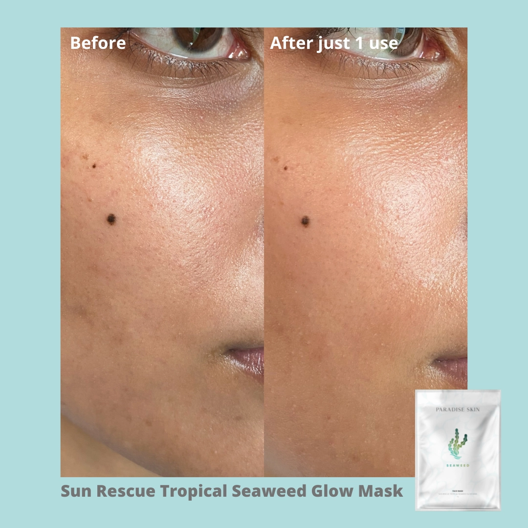 SUN RESCUE-TROPICAL SEAWEED GLOW - 4pack