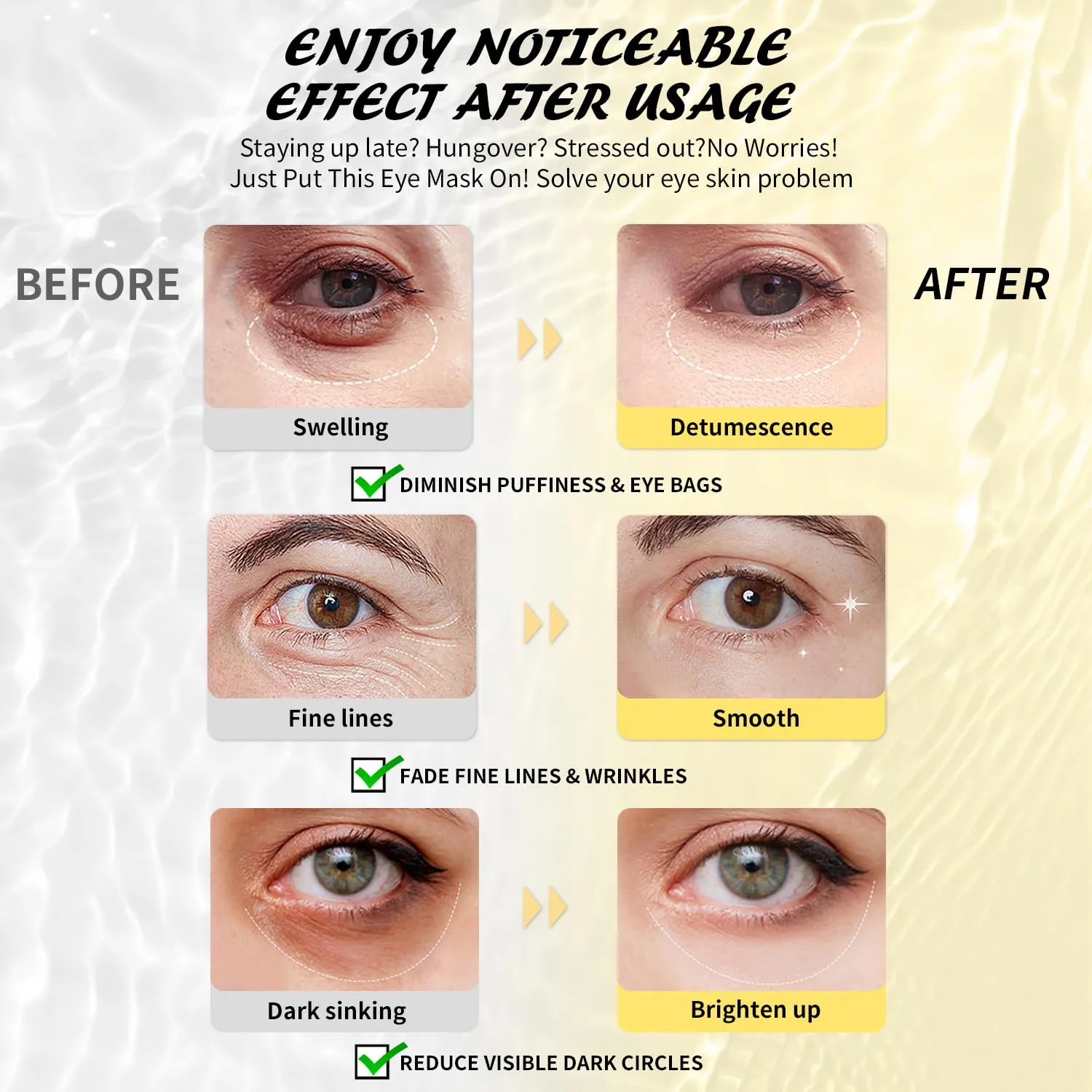 Under Eye Patches (25 Pairs), Caffeine Eye Masks for Dark Circles Puffy Eyes Undereye Bags, Collagen Eye Patches for Wrinkles and Puffiness, Skin Care Gift for Her