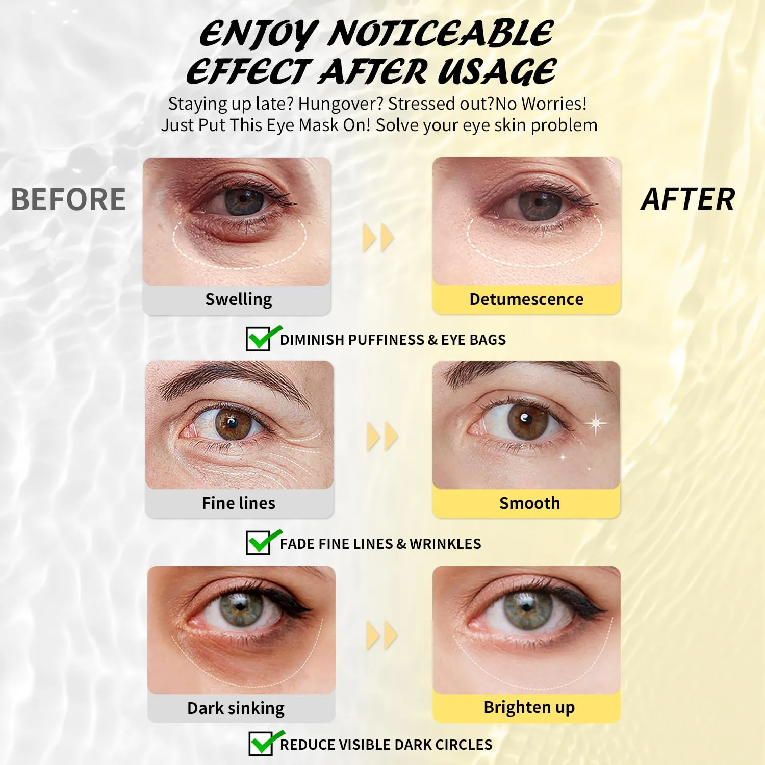 Under Eye Patches (50 Pairs), Aloe Vera Eye Masks for Dark Circles Puffy Eyes Undereye Bags, Collagen Eye Patches for Repair and Intensely Hydrate, Skin Care Gift for Her