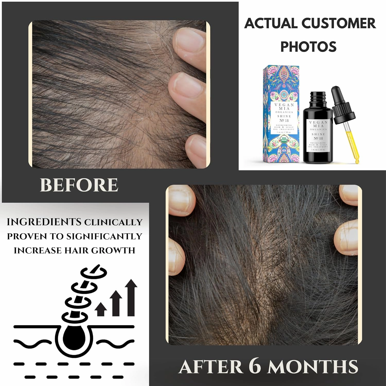 USDA Organic Rosemary Oil for Hair Growth & Intense Nourishment with Castor, Jojoba, Argan, Amla & More Dandruff & Dry Scalp Treatment | Get Healthier, Shiny Hair Naturally, 2 Pack