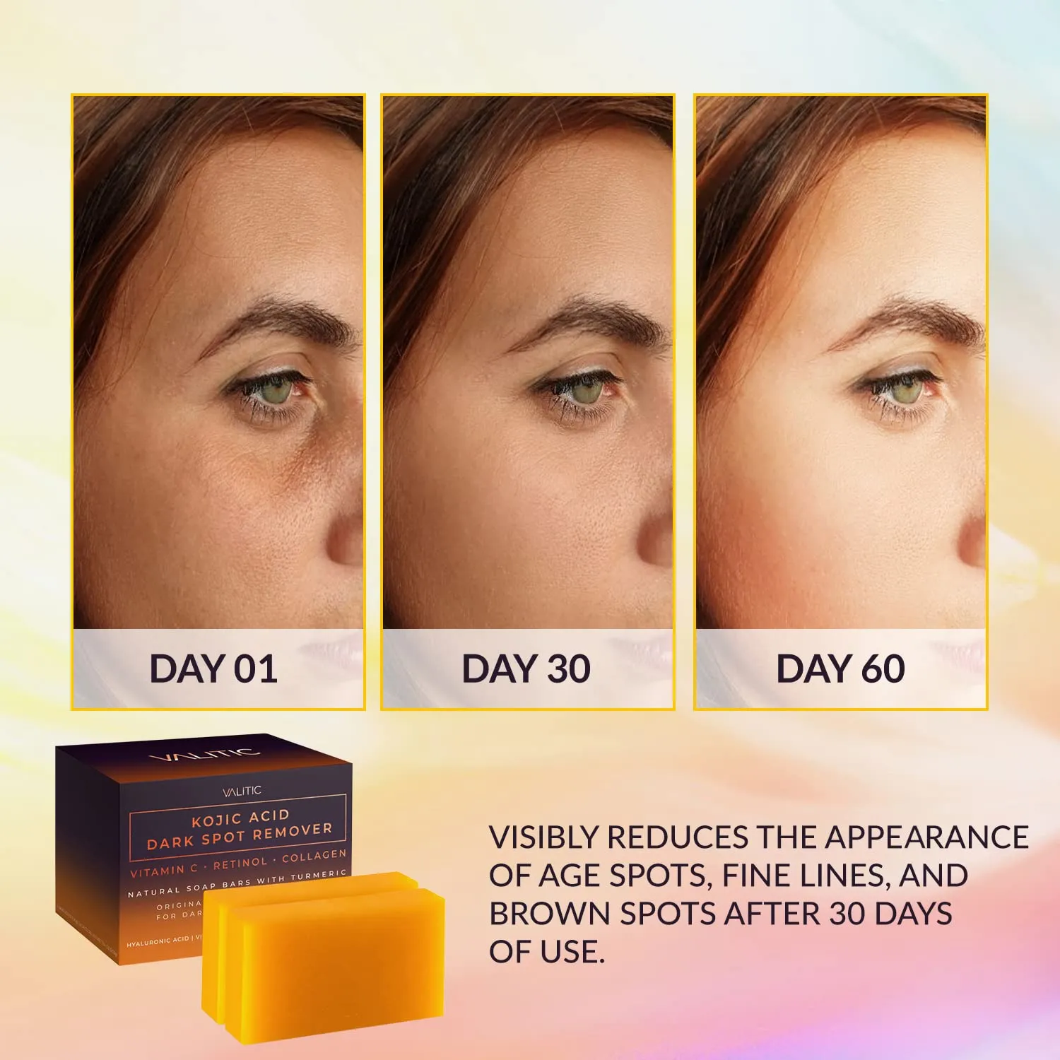 VALITIC Kojic Acid Dark Spot Remover Soap Bar with Vitamin C,Retinol,Collagen,Turmeric - Original Japanese Complex Hyaluronic Acid,E,Shea Butter,Castile Oil (2 Pack) With Holder,Pack of 3,3.5 ounces